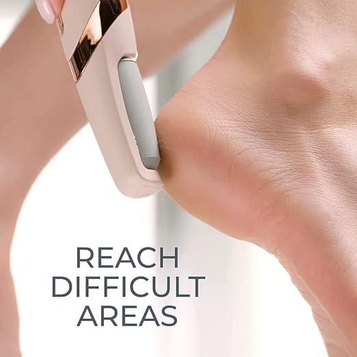 Bos Medicare Surgical Finishing Touch Flawless Pedi Electronic Tool File and Callus Remover, Foot File Callus Remover Too